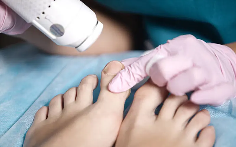 Laser Treatment for Pain and Inflammation