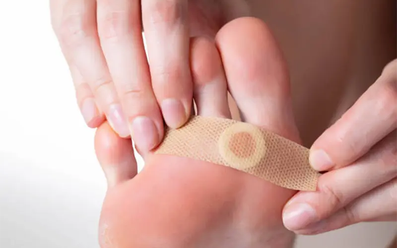 Treatment for foot and ankle warts