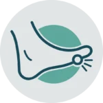 Upperline Health Bunions